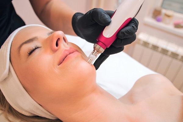 Micro Needling For Great Skin